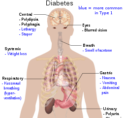 Diabetes Experience:The Biomedical and The Poetic